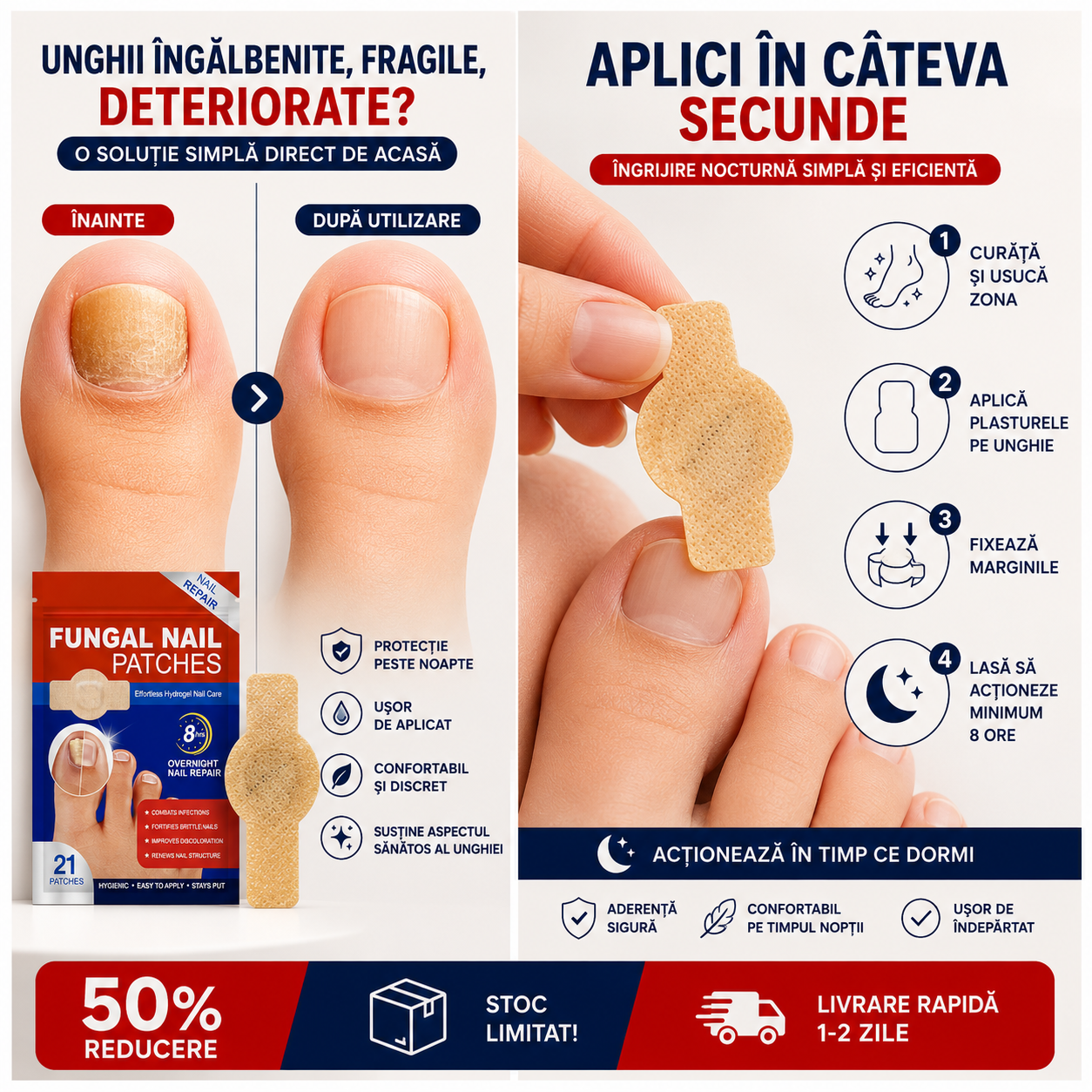 Set 21 Plasturi pentru Unghii Deteriorate si Ingalbenite - Ingrijire Nocturna si Protectie